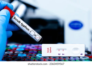  Scrub Typhus Rapid Test